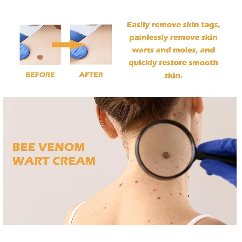 20g Portable Bee Venom Mole and Wart Treatment Cream, Bee Venom Mole and Wart Treatment Cream, Tag Recede Bee Venom for Skin, Bee Venom Cream for Women Men