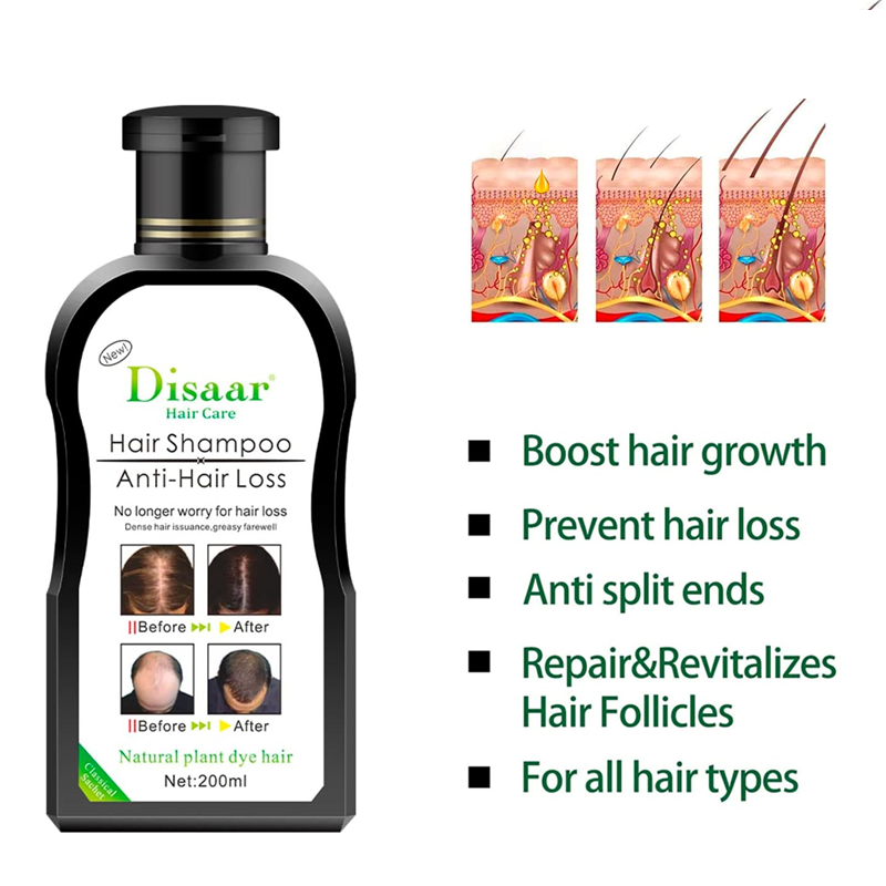 Dissar Menβs Hair Loss Thickening Shampoo with Growth Serum β Dexe C1, 200ml