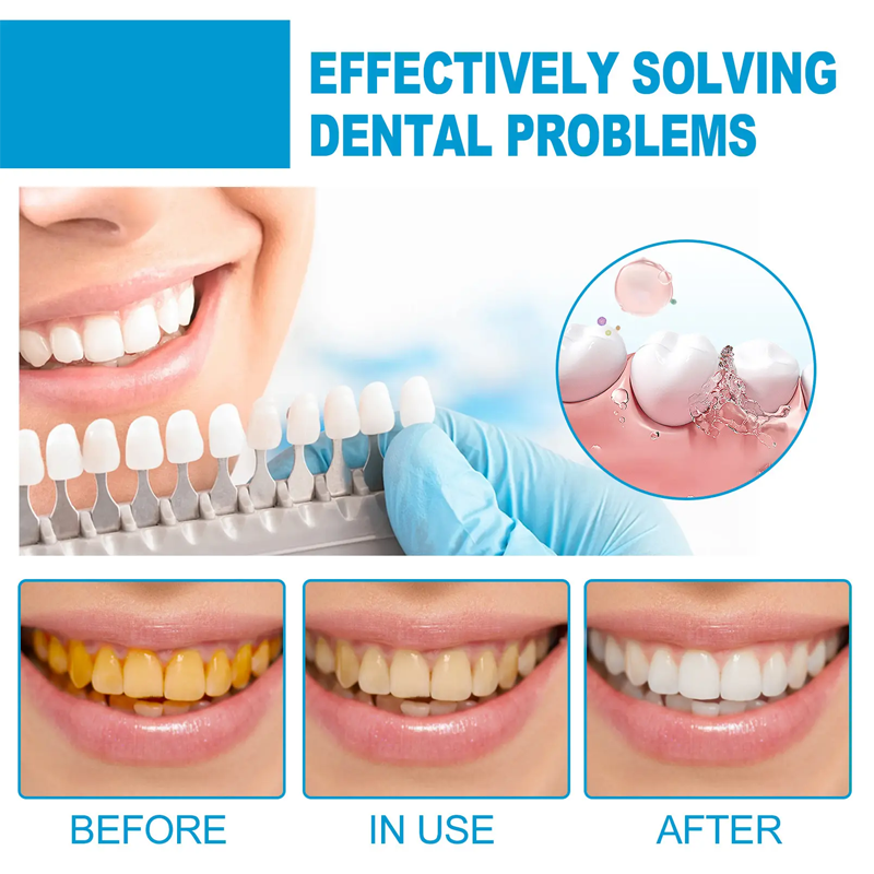 Teethaid Mouthwash, Calculus Removal, Teeth Whitening, Healing Mouth, Teeth Aid Mouthwash, Saltdays Teeth Whitening Foam Toothpaste, Nature Teeth Mousse Foam Oral Care, Refresh The Breath (1pcs)