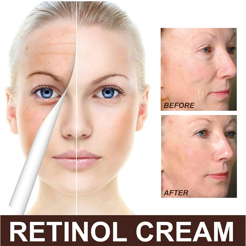 Retinol Face Cream, Anti Wrinkle Face Cream Retinol, Anti-Aging Retinol Cream, Retinol Moisturizing Face Cream, Retinol Cream With Hyaluronic Acid, Tightening & Lightened Skin Tone (30g)