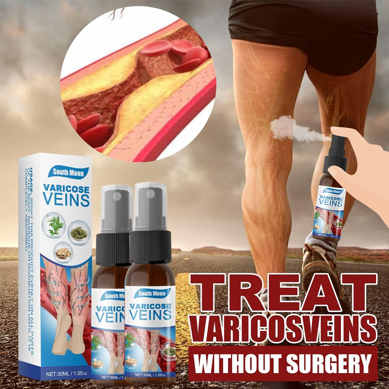 Varicose Veins Treatment Spray – Natural Herbal Relief for Leg Vein Health – 2 x 30ML