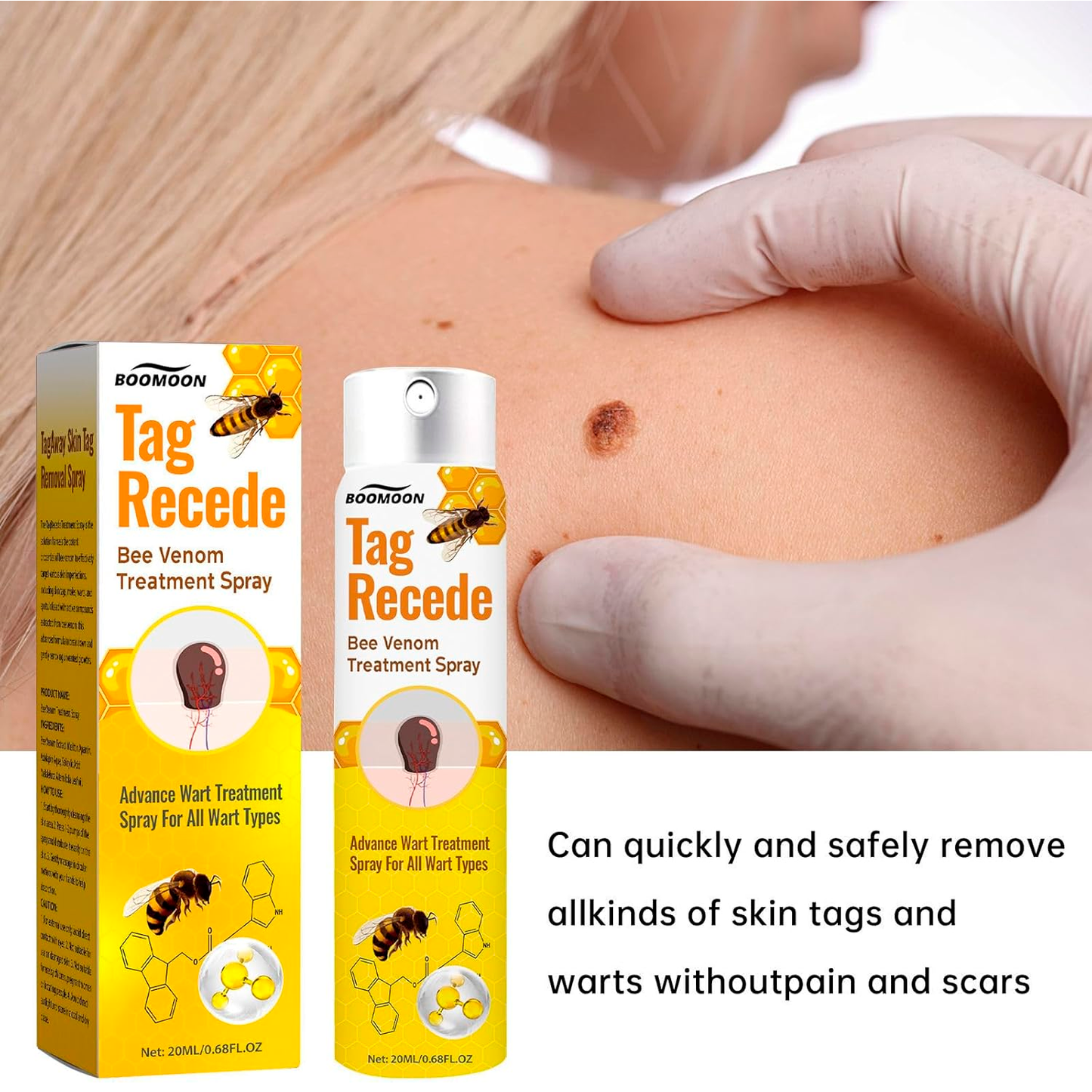 Tag Recede Bee Venom Treatment Spray | Natural Bee Venom Spray for Skin Tags & Blemishes