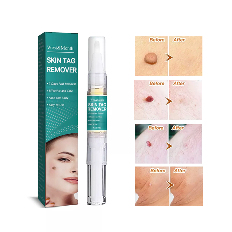 Wipe Off Skin Tag & Mole Remover - Safe for All Body Parts