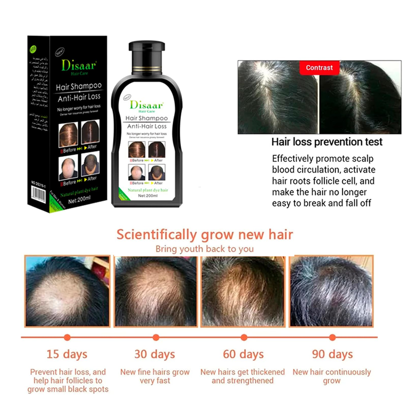 Dissar Menβs Hair Loss Thickening Shampoo with Growth Serum β Dexe C1, 200ml