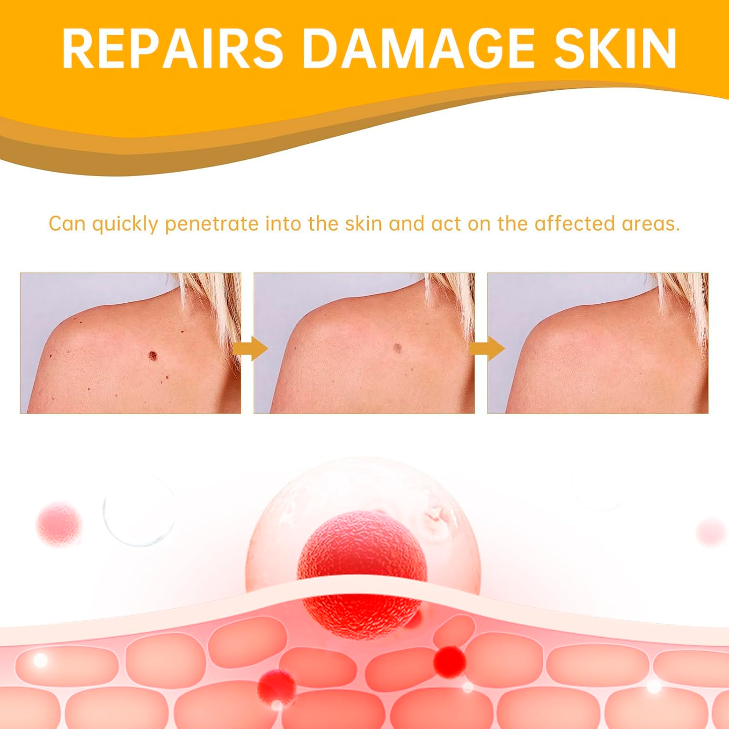 Tag Recede Bee Venom Treatment Spray | Natural Bee Venom Spray for Skin Tags & Blemishes