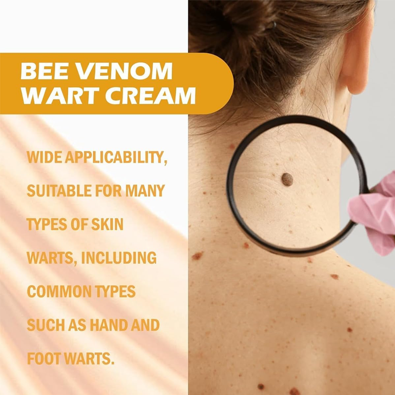 20g Portable Bee Venom Mole and Wart Treatment Cream, Bee Venom Mole and Wart Treatment Cream, Tag Recede Bee Venom for Skin, Bee Venom Cream for Women Men