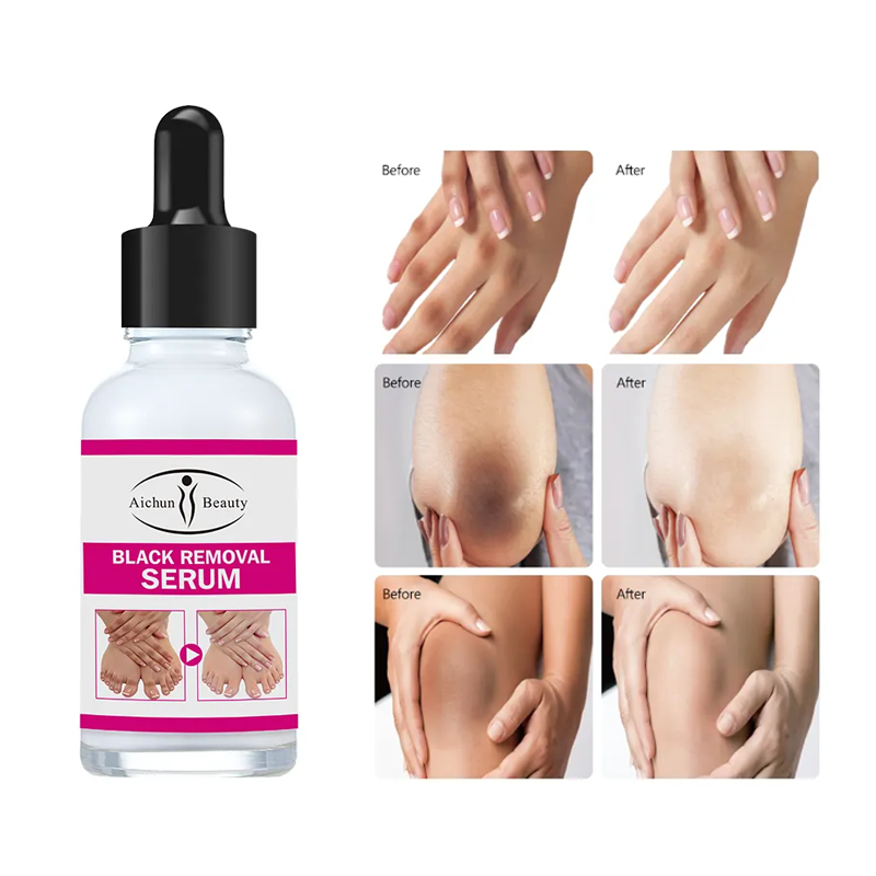Aichun Beauty 30ml Organic Natural Joint Super Whitening Serum โ Vitamin E Body Serum for Intense Skin Brightening
