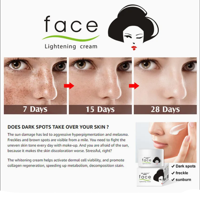 Kojie Face Lightening Cream 30g – Skin Whitening & Brightening with Kojic Acid for Dark Spots