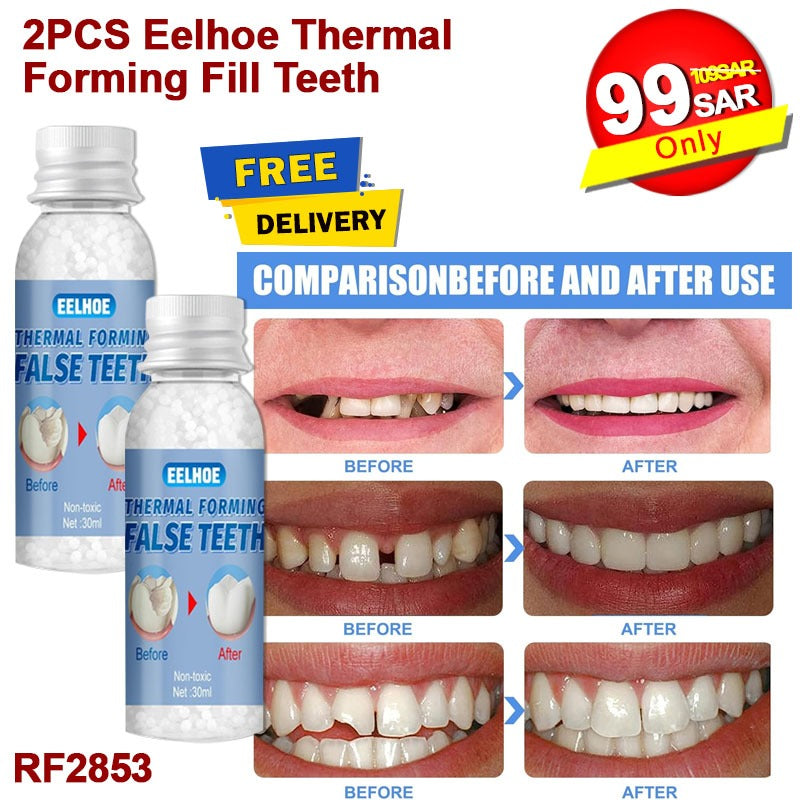 Tooth Repair Granules Temporary Tooth Repair Kit Fitting Beads Reusable, Moldable False Teeth, Moldable False Teeth Thermal Beads, Moldable False Teeth , Safety Filling Fix Glue Denture (30ML)