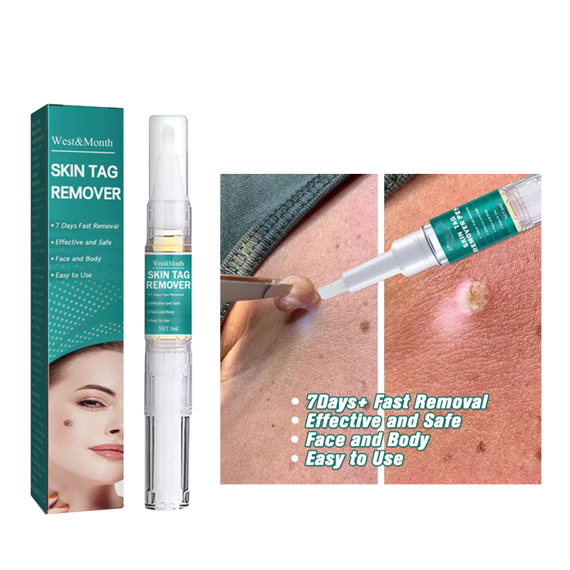 Wipe Off Skin Tag & Mole Remover - Safe for All Body Parts