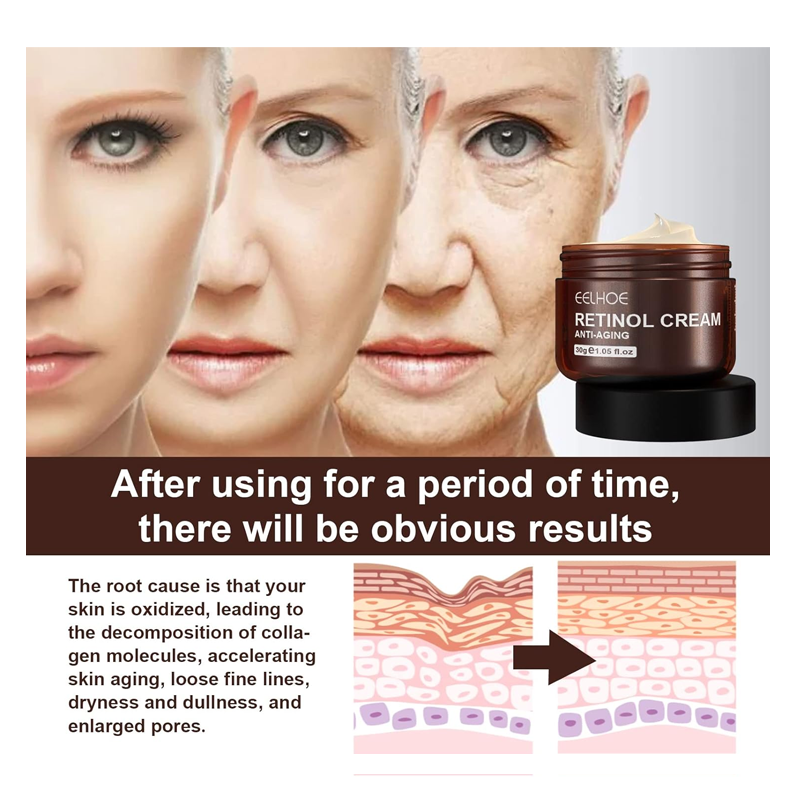 Retinol Face Cream, Anti Wrinkle Face Cream Retinol, Anti-Aging Retinol Cream, Retinol Moisturizing Face Cream, Retinol Cream With Hyaluronic Acid, Tightening & Lightened Skin Tone (30g)
