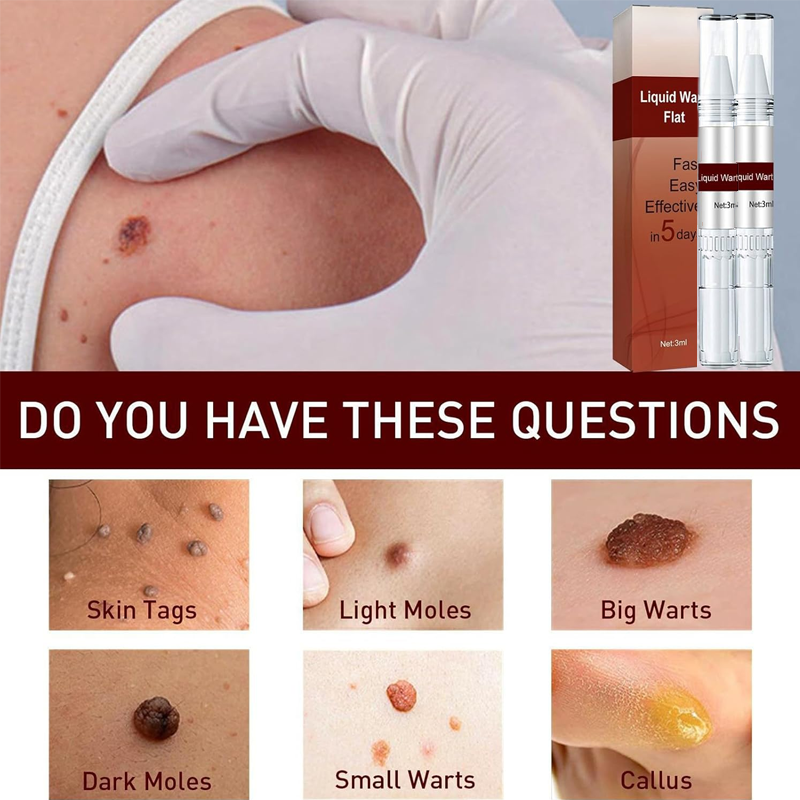 Wipeoff Tags & Moles Remover, Wipe Off Skin Tags and Mole Remover, CC Tags & Moles Remover,Wipe Off Tags & Mole Remover Fast Easy Effective (2 Pcs)