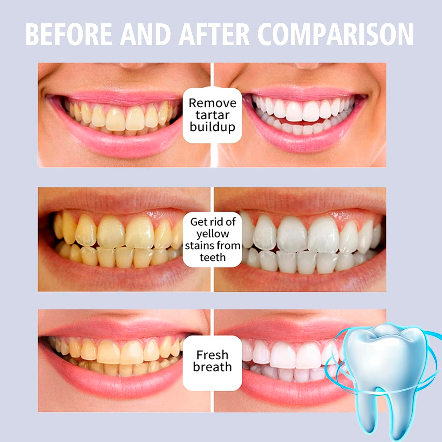Nicesmaile Tooth Gloss | Instant Whitening Wand for a Brilliant Smile