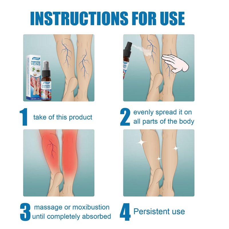 Varicose Veins Treatment Spray – Natural Herbal Relief for Leg Vein Health – 2 x 30ML