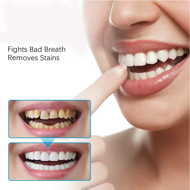 Teethaid Mouthwash, Calculus Removal, Teeth Whitening, Healing Mouth, Teeth Aid Mouthwash, Saltdays Teeth Whitening Foam Toothpaste, Nature Teeth Mousse Foam Oral Care, Refresh The Breath (1pcs)