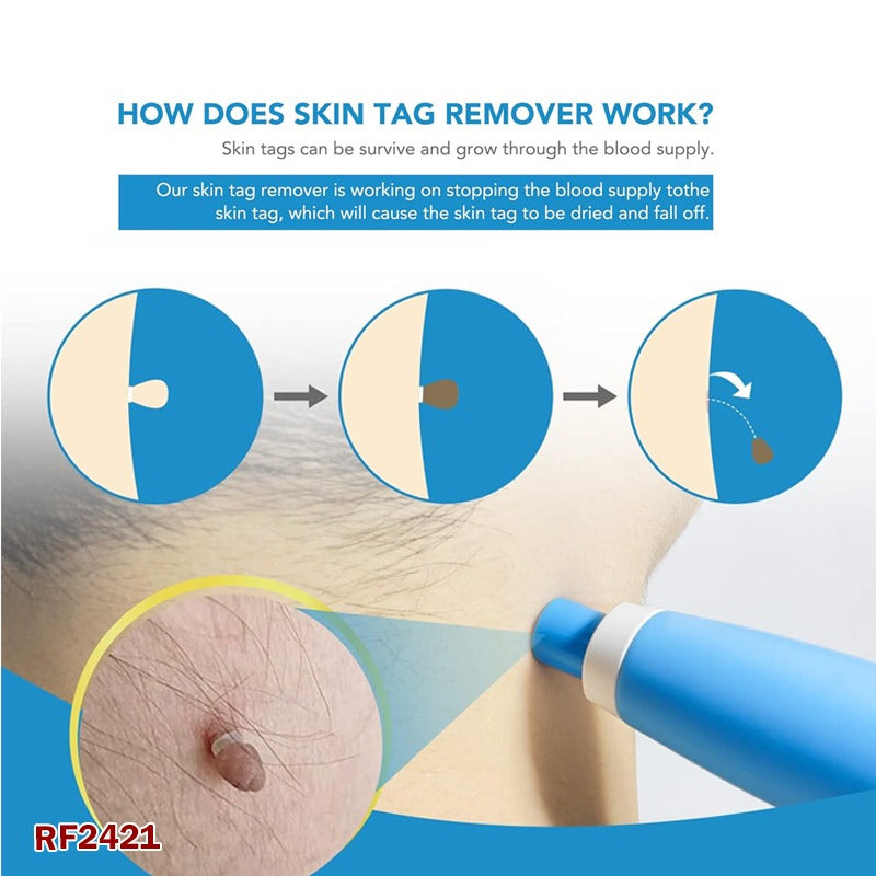 Lerkely Skin Tag Remover | 2 in 1 Skin Tag & Mole Remover Pen, Painless Wart & Skin Tag Remover Kit for All Body Parts (2mm to 8mm)
