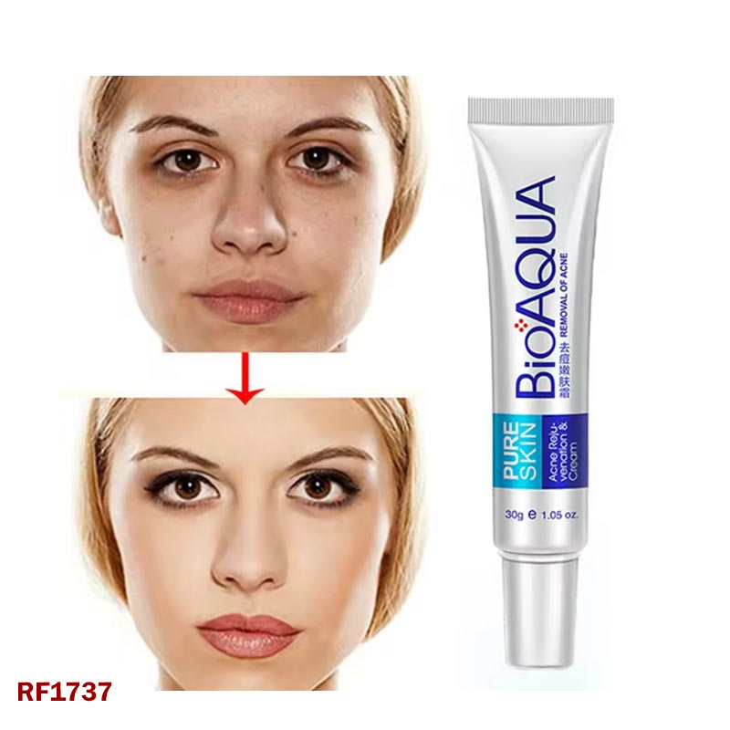 BioAqua Pure Skin Acne and Rejuvenating Cream 30Grams Removal of acne