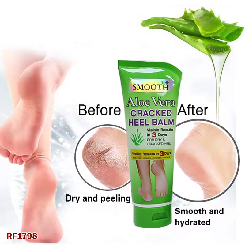 Smooth aloe vera cracked heel balm 100 ml for dry and cracked heel