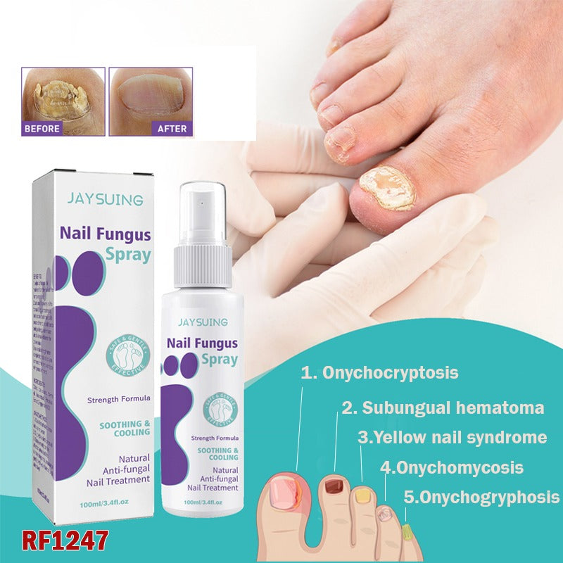 Advanced Foot & Nail Spray: Strengthen and Protect Your Nails!