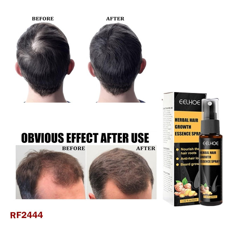 EELHOE Hair Fall Prevention Nourishing Care Solution | Scalp Intensive Hair Loss Treatment | Breakage Herbal Anti-Falling Coil Essence 60ML