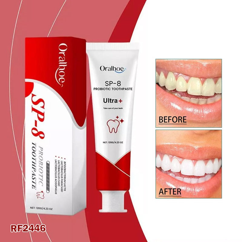 SP8 Probiotic Toothpaste | SP-8 Ultra Whitening Toothpaste | Teeth Whitening & Stain Removal | Fresh Breath Probiotic Toothpaste
