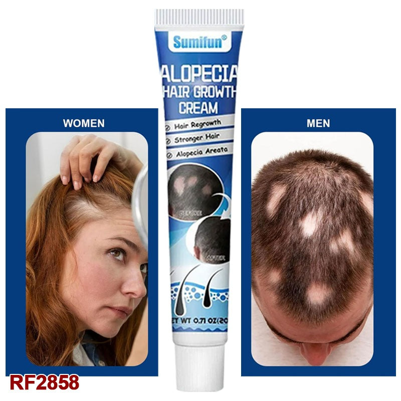 20g New Alopecia Treatment Cream Hair Growing Prevent Alopecia Baldness Regrowth