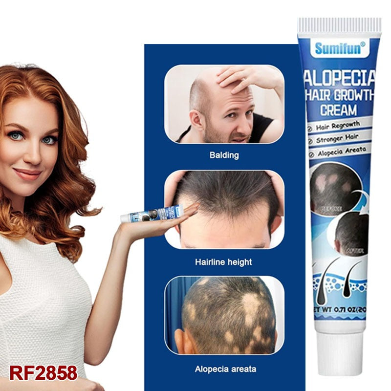 20g New Alopecia Treatment Cream Hair Growing Prevent Alopecia Baldness Regrowth