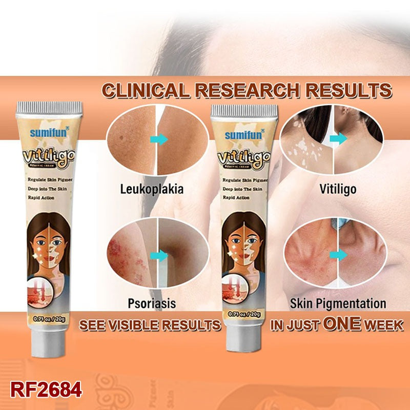 2PCS Sumifun White Spot Cream, White Spot Remover, Vitiligo Cream Natural Treatment for Skin Pigmentation