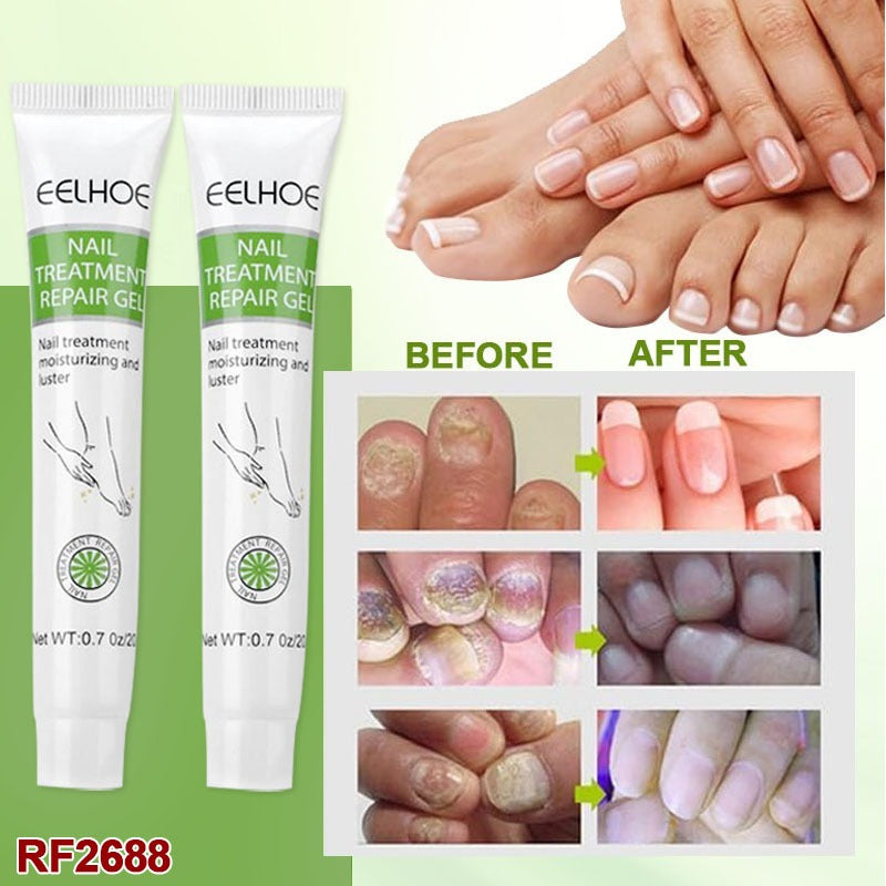 2pcs Nail Repair Gel, Nail Care Cream Nail Treatment Repair and Protect Against Discoloration, Coarse and Crack