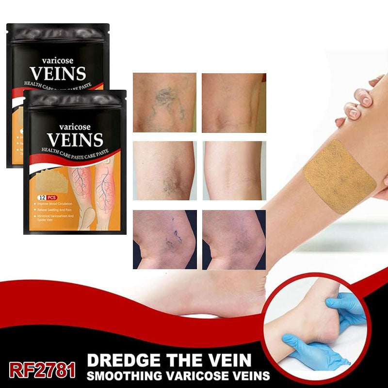24PCS Varicose Spider Veins Removal for Legs Patch, Improve Blood Circulation, Soothing Leg Fatigue