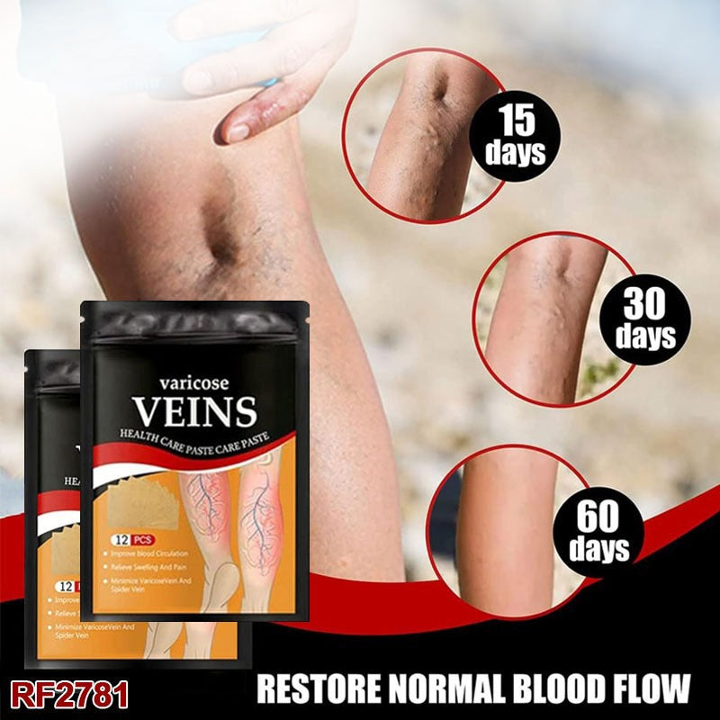 24PCS Varicose Spider Veins Removal for Legs Patch, Improve Blood Circulation, Soothing Leg Fatigue