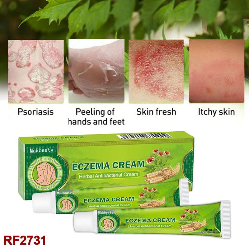 Foloose 2PCS Natural Chinese Herbal Eczema Psoriasis Creams Dermatitis and Rashes Eczema Pruritus Psoriasis Ointment, Psoriasis Treatment, Antibacterial Cream, for Body Itching (2Pcs)