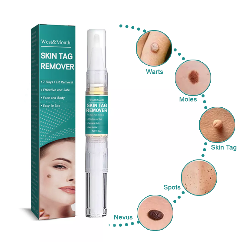 Wipe Off Skin Tag & Mole Remover - Safe for All Body Parts