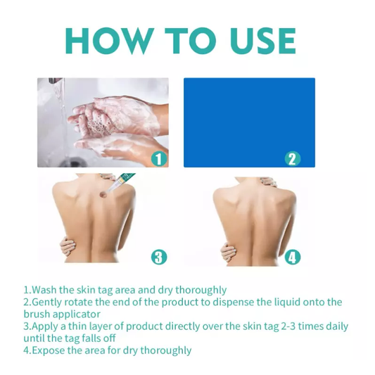 Wipe Off Skin Tag & Mole Remover - Safe for All Body Parts