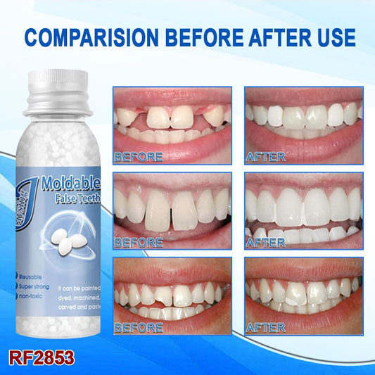 Tooth Repair Granules Temporary Tooth Repair Kit Fitting Beads Reusable, Moldable False Teeth, Moldable False Teeth Thermal Beads, Moldable False Teeth , Safety Filling Fix Glue Denture (30ML)